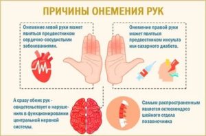 Почему немеют руки во сне во время климакса