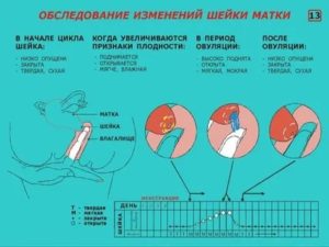 Рыхлая шейка матки при климаксе