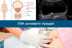 Почему узи матки делают на полный мочевой пузырь или нет