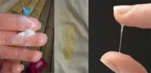 Запах из влагалища после приема антибиотиков