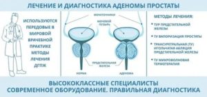 Чага при аденоме простаты механизм действия