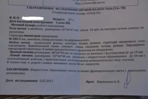 Можно ли принимать клостилбегит при кисте яичника