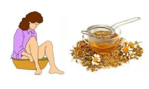 Ванночки с ромашкой при эндометриозе