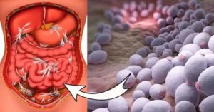 Можно ли заразиться кандидозом кишечника от больного