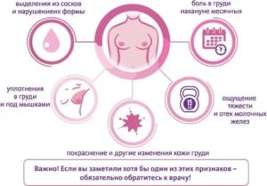 Могут ли быть при месячных чувствительными соски