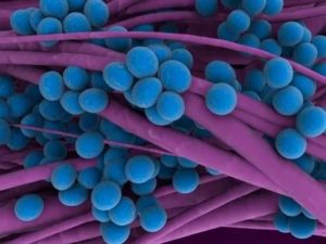 Что это staphylococcus saprophyticus в секрете простаты