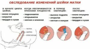 Когда шейка матка опускается перед месячными по дням