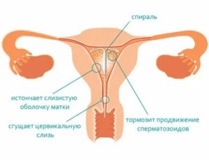 Когда ставят спираль до месячных или после месячных