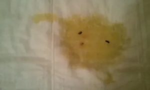 Что если при месячных моча коричневая