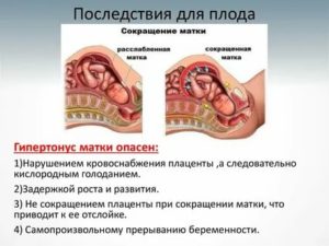 Какие препараты снимают тонус матки в домашних условиях
