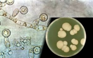 Candida spp при простатите