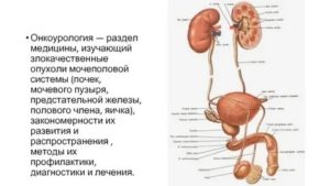 Опухоли в мочеполовой системе мужчины