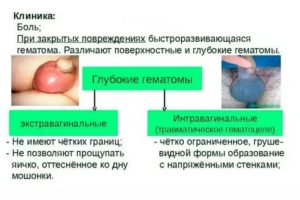 Препарата при ушибе мошонки