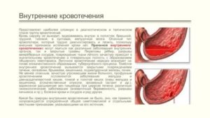 Может ли кровь от месячных попасть в брюшную полость