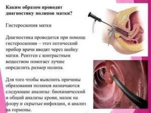 Осложнения после гистероскопии матки симптомы и