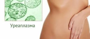 Уреаплазма и кандидоз у женщин лечение