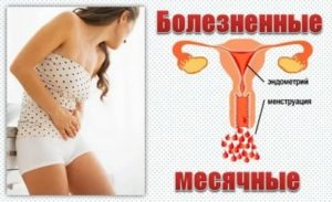 Что делать когда у девушки идут очень болезненно месячные