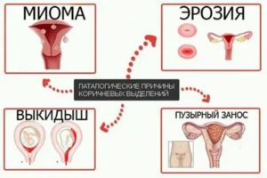 Могут быть месячные при беременности после секса