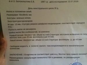 Размеры яичников в норме у женщин по узи на 6 день цикла