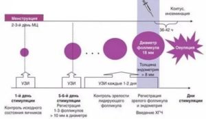 Узи контроль при стимуляции овуляции