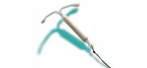 Можно ли при эндометриозе матки крутить обруч