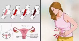 Какого цвета должна быть кровь при менструациях