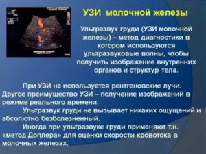 Маммография молочных желез или узи молочных желез что лучше после 40 лет