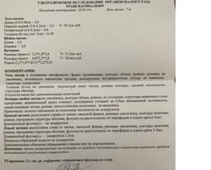 Узи малого таза у женщин на какой день цикла делать при бесплодии