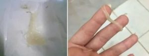 Кровотечение из влагалища при приеме антибиотиков