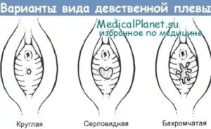 Девственная плева можно ли увидеть на узи