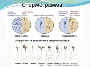 Качество спермы после приема антибиотиков