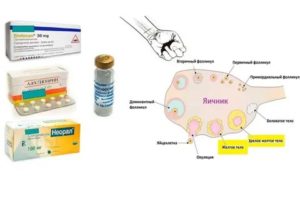 Когда восстанавливаются менструации после химиотерапии