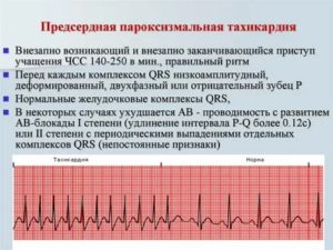 Когда месячные сердцебиение от чего