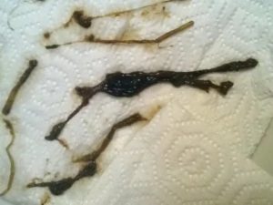 Что может означать когда перед месячными черные выделения