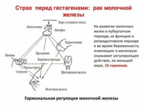 Пролактин зависимые опухоли молочной железы