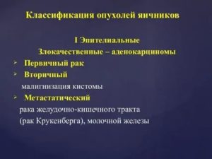 Опухоли и опухолевидные образования яичников у детей