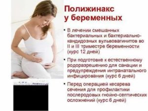 Молочница при беременности 3 триместр лечение полижинаксом