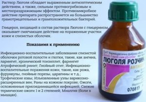 Применение раствора люголя при молочнице