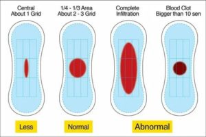 Что делать если нет прокладок а месячные начались сильные