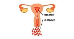 Могут ли после мастурбации начаться месячные