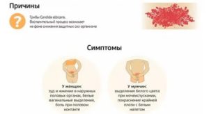 Молочница у пожилых женщин причины лечение