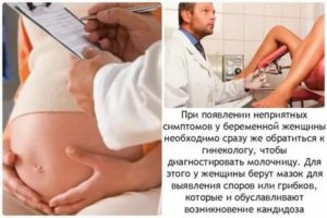 Молочница при беременности чем лечить в 3 триместре отзывы