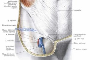 Паховые связки разрыв узи