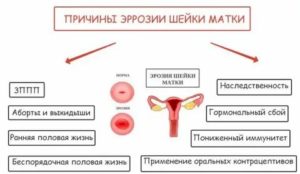 Психосоматика заболевания рака шейки матки