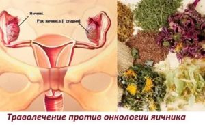 Препараты при опухоли яичника