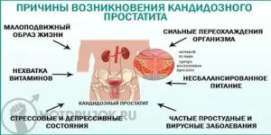 Candida spp при простатите