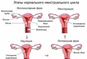 Что может быть за нарушение менструального цикла у девушек