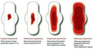 Что это может быть если идут месячные а кровь сильно темная