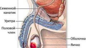 Опухоль и боли в половом члене
