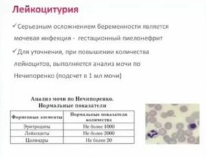 Могут ли быть повышенные лейкоциты в моче перед месячными
